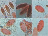 Pertusaria leioplaca image