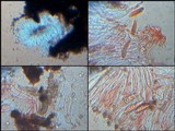 Graphina anguina image