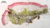 Caloplaca atroflava image
