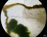 Caloplaca bolacina image