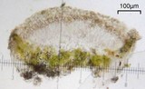 Lecanora polytropa image