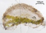 Lecanora polytropa image