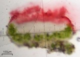 Caloplaca stanfordensis image