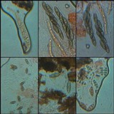 Pyrenula macrospora image