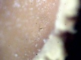 Encoelia heteromera image