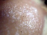 Encoelia heteromera image