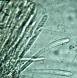 Encoelia heteromera image