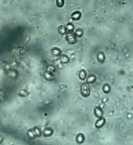 Volvariella bombycina var. flaviceps image