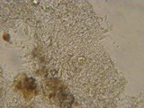 Peniophorella praetermissa image