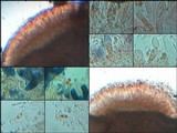 Caloplaca teicholyta image