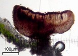 Dactylospora parasitica image