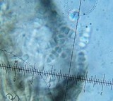 Arthonia albopulverea image