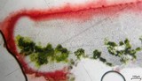 Caloplaca bolacina image