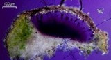 Dimelaena radiata image