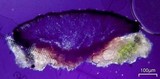 Tephromela atra var. atra image