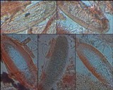 Pertusaria melanochlora image