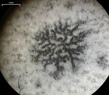Arthonia albopulverea image