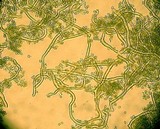 Calvatia pachyderma image