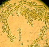 Calvatia pachyderma image