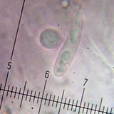 Lecidea diducens image
