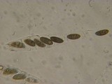 Rosellinia diathrausta image