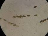 Rosellinia diathrausta image