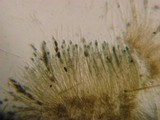 Rosellinia diathrausta image