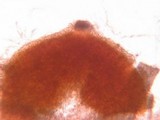 Nectriella sceptri image