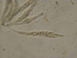 Nectriella sceptri image