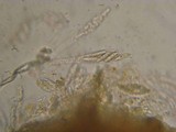 Nectriella sceptri image