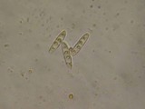 Nectriella sceptri image
