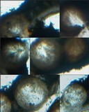 Catapyrenium lachneum image