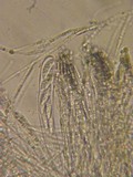 Patellariopsis clavispora image