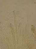 Patellariopsis clavispora image