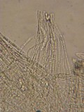 Patellariopsis clavispora image