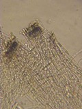 Patellariopsis clavispora image