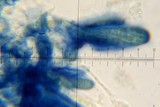 Ophioparma rubricosa image
