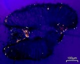 Trapelia glebulosa image