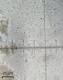 Aspicilia phaea image