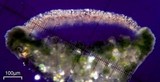Lecanora hybocarpa image