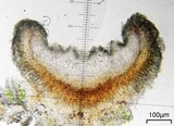 Lecidella euphorea image