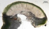 Aspicilia confusa image