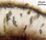 Buellia triseptata image