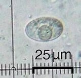 Aspicilia confusa image