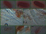 Pertusaria pustulata image
