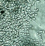 Nectria stilbellae image