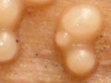 Helicogloea compressa image