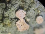 Dibaeis baeomyces image