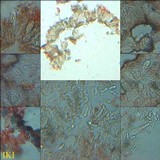 Arthonia elegans image