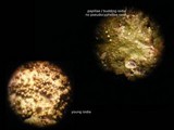 Melanohalea exasperatula image
